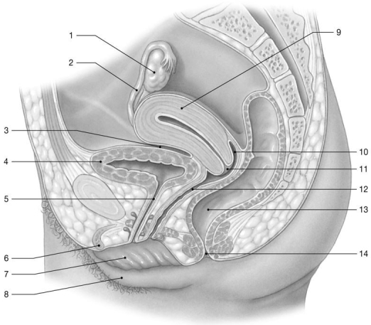   Figure 26-2 -Identify the structure labeled  2.  A) ureter B) uterine tube C) suspensory ligament D) ovarian ligament E) infundibulum