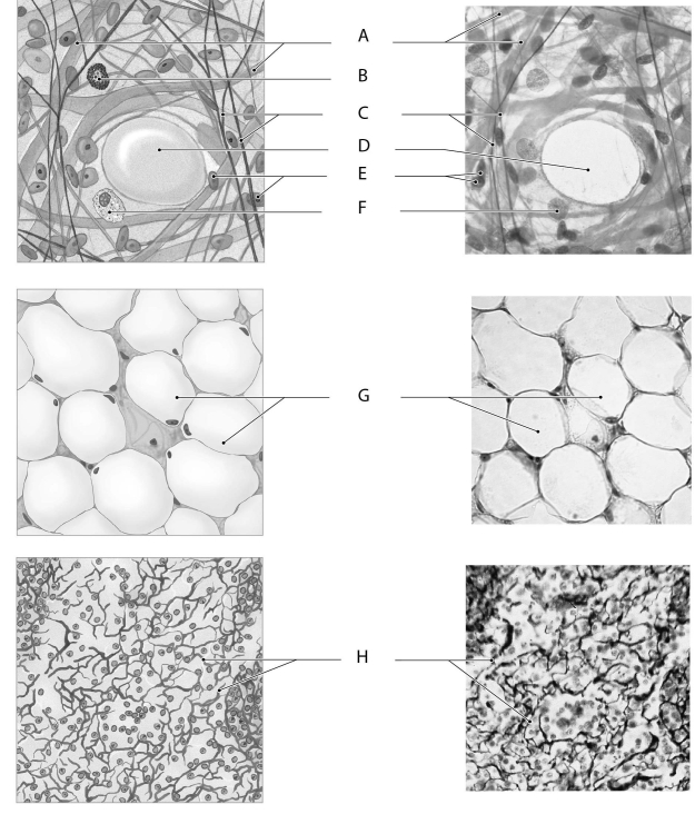 Figure 3.3     Using the figure above, identify the labeled part. -Label E: ______________________________