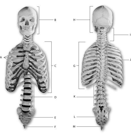 Figure 6.1     Using the figure above, identify the labeled part. -Label B: ______________________________