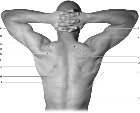 Figure 12.2   Using the figure above, identify the labeled part. Label A: ______________________________<div style=padding-top: 35px> 
