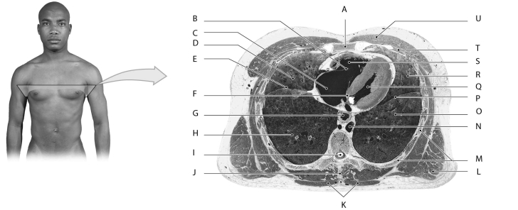 Figure 12.5     Using the figure above, identify the labeled part. -Label M: ______________________________