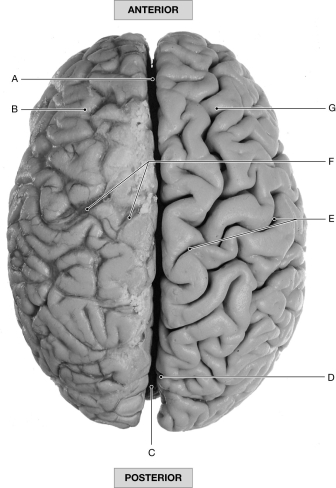 Figure 16.4     Using the figure above, identify the labeled part. -Label A: ______________________________