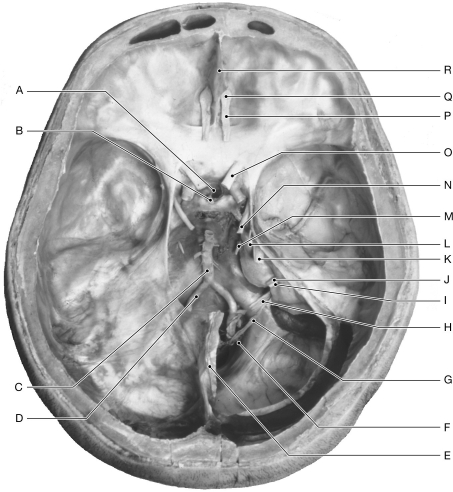 Figure 16.11     Using the figure above, identify the labeled part. -Label R: ______________________________