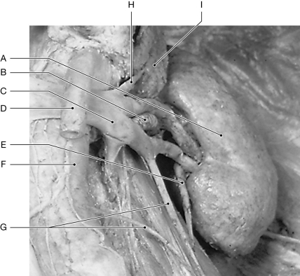 Figure 26.2     Using the figure above, identify the labeled part. -Label C: ______________________________