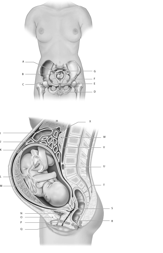Figure 28.3     Using the figure above, identify the labeled part. -Label U: ______________________________