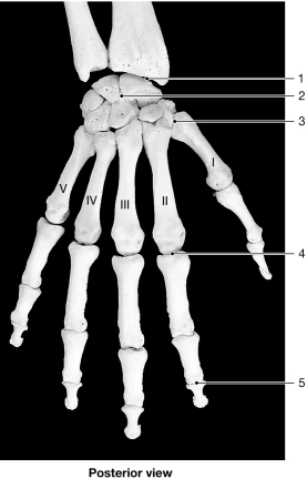    Figure 9-1 Bones of the Wrist and Hand Use Figure 9-1 to answer the following questions: -Identify the type of joint at label  3.  A) hinge B) gliding C) condylar D) saddle E) pivot