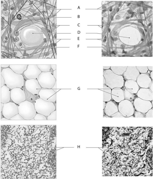 Figure 3.3     Using the figure above, answer the following questions. -Identify the specific structure indicated by Label A. A)  Collagen fibers B)  Microfilaments C)  Reticular fibers D)  Elastic fibers E)  Neurofilaments