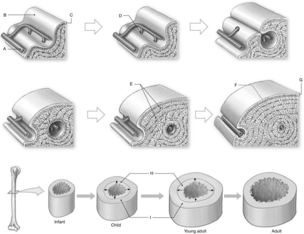 Figure 5.3     Using the above-referenced diagrams depicting events that occur during appositional bone growth, identify the specified labeled part in each of the following questions. -Identify the structure indicated by Label E. A)  Interstitial lamellae B)  Circumferential lamellae C)  Concentric lamellae D)  Periosteum E)  Central canal