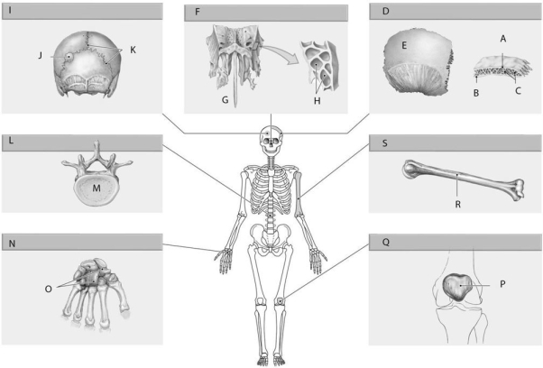 Figure 5.4     Using the above-referenced diagrams of bones classified by shape, identify the specified labeled item in each of the following questions. -Identify the bone type specified by Label Q. A)  Sesamoid bones B)  Carpal bones C)  Pneumatized bones D)  Irregular bones E)  Long bones