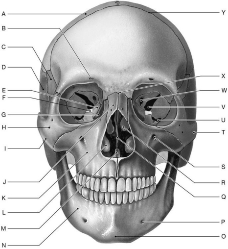 Figure 6.2     Using the above-referenced figure of the anterior view of the bones of the adult skull, identify the specified labeled items in each of the following questions. -Identify the structure indicated by Label M. A)  Palatine bone B)  Vomer C)  Lacrimal bone D)  Ethmoid E)  Sphenoid