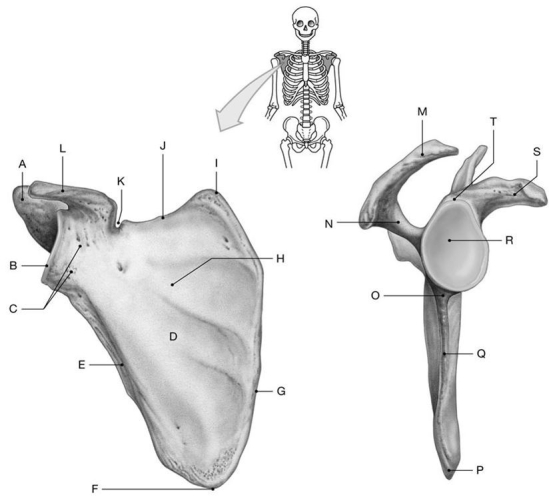 Figure 7.1     Using the above-referenced figures of the costal (anterior) and lateral views of the scapula, identify the specified labeled part in each of the following questions. -Identify the structure indicated by Label D. A)  Glenoid cavity B)  Acromion C)  Coracoid process D)  Body E)  Spine
