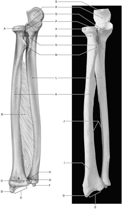 Figure 7.5     Using the above-referenced figures of the anterior view of the radius and ulna, identify the specified labeled items in each of the following questions. -Identify the structure indicated by Label G. A)  Olecranon B)  Ulnar head C)  Coronoid process D)  Styloid process E)  Radial head