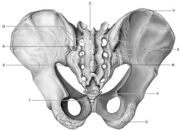 Figure 7.8     Using the above-referenced posterior view of the pelvis, identify the specified labeled part in each of the following questions. -Identify the structure indicated by Label S. A)  Posterior superior iliac spine B)  Posterior inferior iliac spine C)  Anterior superior iliac spine D)  Ischial spine E)  Anterior inferior iliac spine