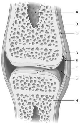 Figure 8.1     Using the above-referenced diagrammatic view of a simple articulation, identify the specified labeled items in each of the following questions. -Identify the structure(s)  indicated by Label A. A)  Meniscus B)  Bursa C)  Articular cartilage D)  Medullary cavity E)  Joint capsule