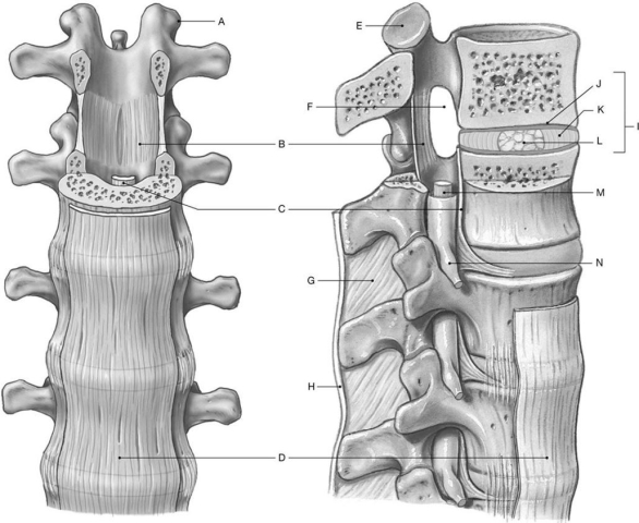 <strong>Figure 8.2 Using the above-referenced anterior view and lateral and sectional views of the intervertebral articulations, identify the specified labeled items in each of the following questions. Identify the structure(s) indicated by Label A.</strong> A) Transverse process B) Intervertebral foramen C) Spinous process D) Ligamentum flavum E) Superior articular process