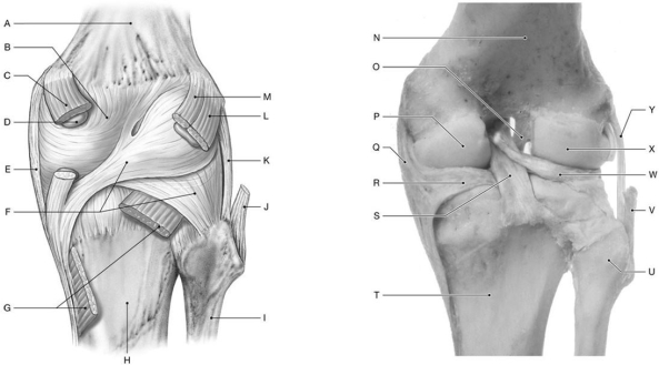 Figure 8.5     Using the above-referenced posterior views of the extended right knee (joint capsule removed in right side cadaveric image) , identify the specified labeled items in each of the following questions. -Identify the structure(s)  indicated by Label R. A)  Lateral meniscus B)  Lateral condyle C)  Medial condyle D)  Medial meniscus E)  Posterior cruciate ligament