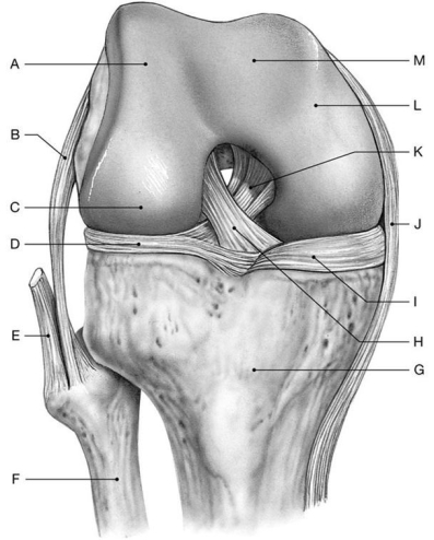 Figure 8.6     Using the above-referenced anterior view of the right knee at full flexion (joint capsule, patella, and associated ligaments removed) , identify the specified labeled items in each of the following questions. -Identify the structure(s)  indicated by Label J. A)  Tibial collateral ligament B)  Anterior cruciate ligament C)  Posterior cruciate ligament D)  Medial meniscus E)  Fibular collateral ligament