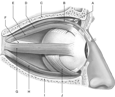 Figure 10.3     Using the above-referenced diagrammatic view of extra-ocular muscles on the lateral surface of the right eye, identify the specified labeled item(s) in each of the following questions. -Identify the structure(s)  indicated by Label A. A)  Optic nerve B)  Superior oblique C)  Oculomotor nerve D)  Superior rectus E)  Trochlea