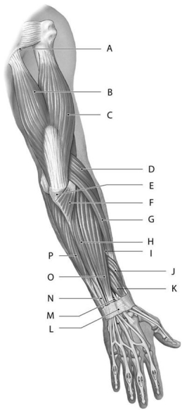 Figure 11.4     Using the above-referenced figure of the posterior view of a dissection of the superficial muscles of the right upper limb, identify the specified labeled structure(s)  in each of the following questions. -Identify the structure(s)  indicated by Label P. A)  Flexor carpi radialis B)  Flexor digitorum superficialis C)  Extensor carpi ulnaris D)  Flexor carpi ulnaris E)  Extensor carpi radialis