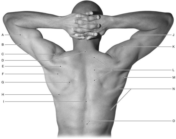 Figure 12.2     Using the above-referenced figure illustrating the back and shoulder regions of the thorax, identify the specified labeled structure(s)  in each of the following questions. -Identify the structure(s)  indicated by Label J. A)  Triceps brachii muscle B)  Biceps brachii muscle C)  Deltoid muscle D)  Brachialis muscle E)  Brachioradialis muscle