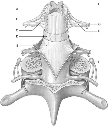 Figure 14.2     Using the above-referenced diagram of a posterior view of the spinal cord showing the meningeal layers, superficial landmarks, and distribution of gray and white matter, identify the specified labeled structure(s)  in each of the following questions. -Identify the structure(s)  indicated by Label B. A)  Dorsal root B)  Denticulate ligament C)  Arachnoid mater D)  Ventral root E)  Dura mater