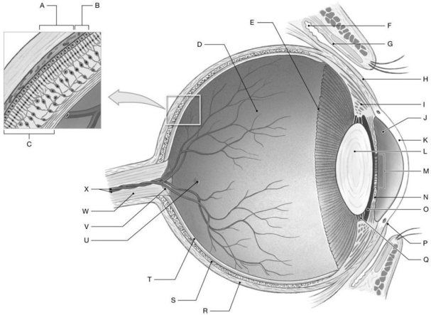 Figure 18.3     Using the figure above, identify the labeled structure(s)  in each of the following questions. -Identify the structure(s)  indicated by Label T. A)  Iris B)  Choroid C)  Cornea D)  Sclera E)  Retina