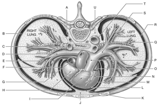 Figure 21.1     Using the above figure, identify the labeled structure(s)  in each of the following questions. -Identify the structure(s)  indicated by Label S. A)  Superior vena cava B)  Pulmonary artery C)  Brachiocephalic trunk D)  Pulmonary vein E)  Aorta