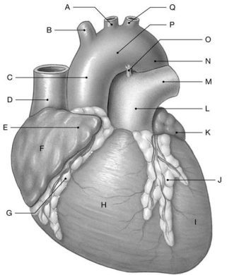 Figure 21.2     Using the above figure, identify the labeled structure(s)  in each of the following questions. -Identify the structure(s)  indicated by Label H. A)  Auricle B)  Ventricle C)  Coronary sulcus D)  Atrium E)  Interventricular sulcus