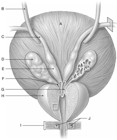 Figure 27.3     Identify the labeled structure(s)  in each of the following questions. -Identify the structure indicated by Label H. A)  Urinary bladder B)  Prostate gland C)  Seminal gland D)  Bulbo-urethral gland E)  Testis