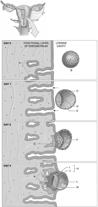 Figure 28.1     Identify the labeled structure(s)  in each of the following questions. -Identify the structure indicated by Label E. A)  Lacuna B)  Cytotrophoblast C)  Amniotic cavity D)  Inner cell mass E)  Blastocoele