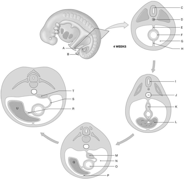 Figure 28.5     Identify the labeled structure(s)  in each of the following questions. -Identify the structure indicated by Label Q. A)  Lesser omentum B)  Greater omentum C)  Notochord D)  Liver E)  None of the answers are correct.