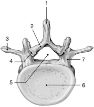    Figure 7-2 Typical Vertebra (inferior view)  Use Figure 7-2 to answer the following questions: -Which structure contacts the intervertebral disc? A) 2 B) 3 C) 4 D) 5 E) 6