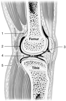    Figure 9-1 A Simplified Sectional View of the Knee Joint Use Figure 9-1 to answer the following questions: -Identify the structure at label   1.  A) meniscus B) bursa C) articular cartilage D) synovial membrane E) joint cavity