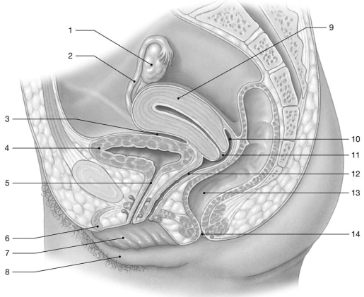    Figure 28-2 The Female Reproductive System Use Figure 28-2 to answer the following questions: -What is produced by the structure labeled  1 ? A) eggs B) estrogen C) progesterone D) inhibin E) All of the answers are correct.