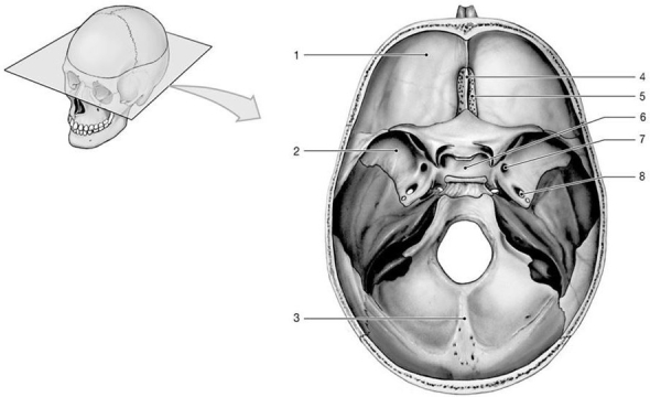 Figure 7-1 Floor of the Cranial Cavity    Use Figure 7-1 to answer the following questions: -What is the name of the structure labeled  8 ? A)  sella turcica B)  foramen ovale C)  foramen rotundum D)  carotid canal E)  foramen spinosum