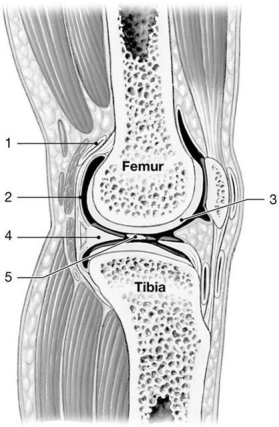 Figure 9-1 A Simplified Sectional View of the Knee Joint    Use Figure 9-1 to answer the following questions: -Identify the structure labeled  5.  A)  serous membrane B)  synovial membrane C)  joint capsule D)  periosteum E)  intracapsular ligament