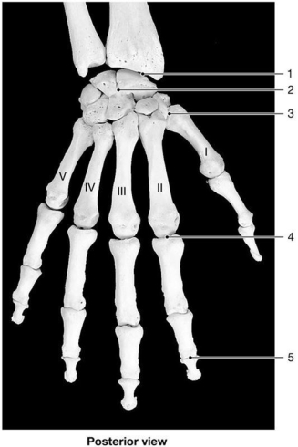 <strong> Figure 9-2 Bones of the Wrist and Hand Use Figure 9-2 to answer the following questions: Identify the type of joint at label 4.</strong> A) hinge B) gliding C) condylar D) saddle E) pivot