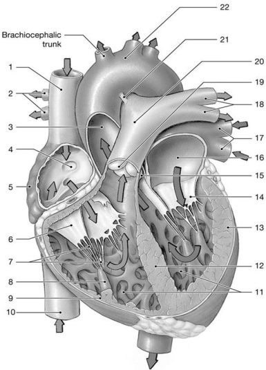 Figure 20-1 The Heart    Use Figure 20-1 to answer the following questions: -Which chamber receives oxygenated blood from the pulmonary circuit? A)  5 B)  10 C)  16 D)  13 E)  both 5 and 16