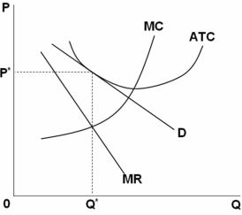 <strong> Refer to the above graph.This monopolistically competitive firm is:</strong> A) suffering an economic loss. B) earning an economic profit. C) allocatively and productively efficient. D) neither allocatively nor productively efficient.