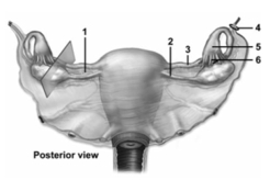   -This figure shows a posterior view of the organs of the female reproductive system.Which number indicates the suspensory ligament? A) 1 B) 2 C) 3 D) 4 E) 5