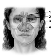   -Which sinus does the number 3 indicate? A) Frontal sinus B) Ethmoidal sinus C) Maxillary sinus D) Sphenoidal sinus E) Dural venous sinus