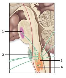   -This figure shows respiratory control centers in the brainstem.What does number 2 indicate? A) Central chemoreceptors B) Pontine respiratory group C) Dorsal respiratory group D) Ventral respiratory group