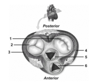   -In this figure showing an oblique section of the heart,number 3 depicts the A) wall of the left ventricle. B) wall of the right atrium. C) wall of the left atrium. D) wall of the right ventricle. E) left atrioventricular valve.