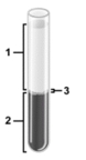   -In the centrifuged sample of blood illustrated,what blood components are contained in the layer labeled number 3? A) Leukocytes and platelets B) Plasma and water C) Erythrocytes D) Plasma,water,waste materials,and electrolytes E) Leukocytes and waste materials