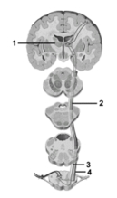   -This figure shows the anterolateral pathway.What structure does number 4 indicate? A) Tertiary neuron B) Primary neuron C) Anterior spinothalamic tract D) Lateral spinothalamic tract E) Posterior spinothalamic tract