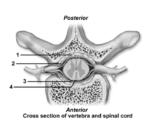 This figure shows a cross section of a vertebra and the spinal cord.What structure does number 1 indicate?   A) Epidural space B) Pia mater C) Subarachnoid space D) Central canal E) Dura mater