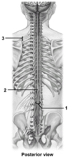   -This figure shows the spinal cord and spinal nerves.What structure does number 2 indicate? A) Dura mater B) Filum terminale C) Cauda equina D) Conus medullaris E) Posterior rootlets