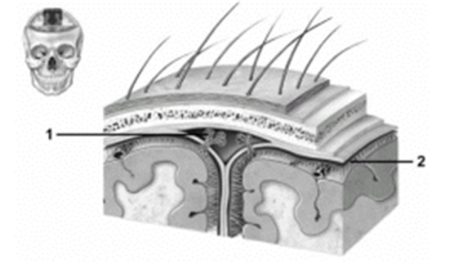   -This figure shows the cranial meninges.What structure does number 1 indicate? A) Pia mater B) Arachnoid C) Dura mater D) Dural venous sinus E) Arachnoid granulation