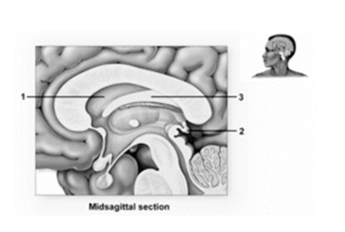   -This figure shows the diencephalon.What structure does number 1 indicate? A) Corpus callosum B) Septum pellucidum C) Fornix D) Thalamus E) Pineal gland