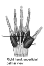   -This figure shows a palmar view of the hand.What muscle does number 1 indicate? A) Abductor pollicis brevis B) Flexor digiti minimi brevis C) Opponens pollicis D) Adductor pollicis E) Lumbrical